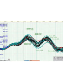 CT Viewer 2 Software - 1