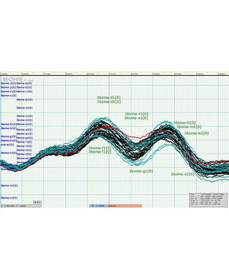 CT Viewer 2 Software - 1